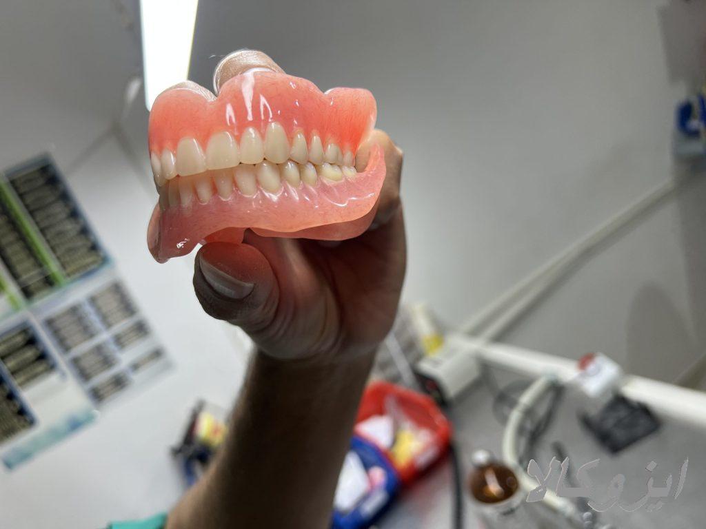 ساخت پروتز دندان(دندان مصنوعی)