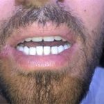 دندانسازی حرفه ای