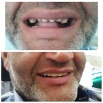 دندانسازی حرفه ای
